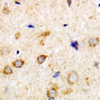19 - Anti-Rabphilin 3A Antibody AP53368