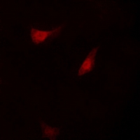 3 - Anti-S6K1 Antibody AP53369