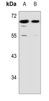 1 - Anti-S6K1 Antibody AP53369