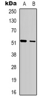 1 - Anti-SH2D2A Antibody AP53374
