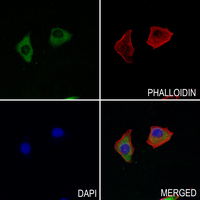 3 - Anti-WIPF1 Antibody AP53378