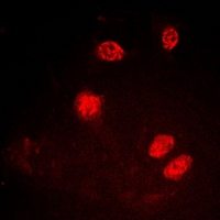 3 - Anti-Ku80 (Phospho-T714) Antibody AP53379