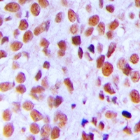 19 - Anti-Ku80 (Phospho-T714) Antibody AP53379