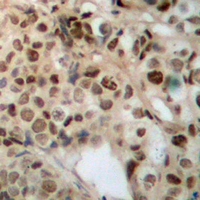 19 - Anti-ZFYVE19 Antibody AP53381