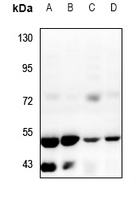 1 - Anti-ZFYVE19 Antibody AP53381