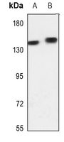 1 - Anti-Adenylate Cyclase 5/6 Antibody AP53655