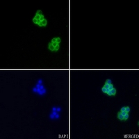 3 - Anti-Aggrecan Antibody AP53656