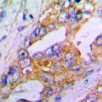 19 - Anti-Aggrecan Antibody AP53656