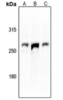 1 - Anti-Aggrecan Antibody AP53656