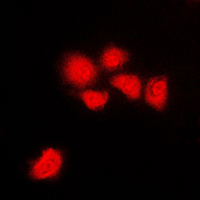 3 - Anti-CDK1/2/3 (Phospho-T14) Antibody AP53658