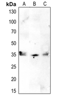1 - Anti-CDK1/2/3 (Phospho-T14) Antibody AP53658