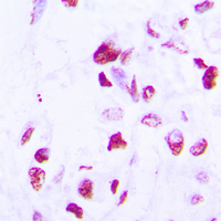 19 - Anti-C/EBP delta/epsilon Antibody AP53659
