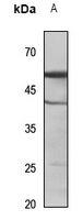 1 - Anti-Cytochrome P450 2C9 Antibody AP53664