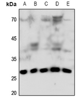 1 - Anti-Connexin 32 Antibody AP53672