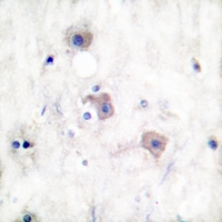 19 - Anti-mGLUR2 Antibody AP53676