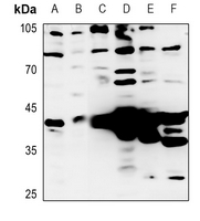 1 - Anti-Granzyme B/H Antibody AP53677