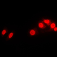 3 - Anti-Histone H1 Antibody AP53678