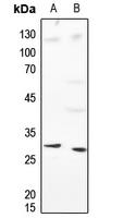 1 - Anti-Histone H1 Antibody AP53678