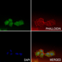 3 - Anti-hnRNP H Antibody AP53679