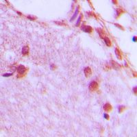 19 - Anti-hnRNP H Antibody AP53679