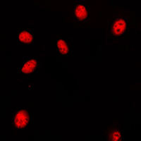 3 - Anti-HOXA11/D11 Antibody AP53680