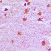 19 - Anti-HOXA11/D11 Antibody AP53680