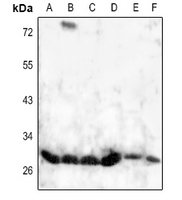 1 - Anti-HOXD8 Antibody AP53682