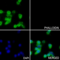 3 - Anti-NRAS/HRAS/KRAS Antibody AP53683