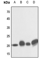 1 - Anti-NRAS/HRAS/KRAS Antibody AP53683