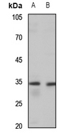 1 - Anti-MAGEA3/6 Antibody AP53687