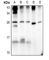 1 - Anti-ATP6 Antibody AP53689