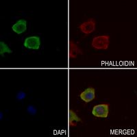 3 - Anti-Orosomucoid 2 Antibody AP53692