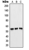 1 - Anti-PFKFB1/4 Antibody AP53694