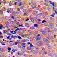 19 - Anti-AMPK alpha 1/2 Antibody AP53697