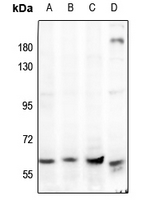 1 - Anti-AMPK alpha 1/2 Antibody AP53697