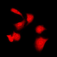 3 - Anti-PKA C alpha/beta Antibody AP53698