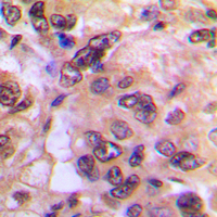 19 - Anti-PKA C alpha/beta Antibody AP53698
