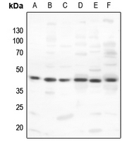 1 - Anti-PKA C alpha/beta Antibody AP53698