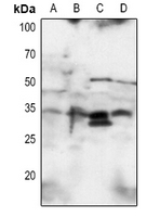 1 - Anti-SNAI1 Antibody AP53703