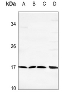 1 - Anti-Spasmolysin Antibody AP53706