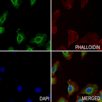 3 - Anti-TSG6 Antibody AP53707