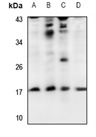 1 - Anti-UBE2A/B Antibody AP53708