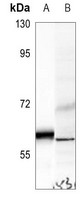 1 - Anti-UGCG Antibody AP53709