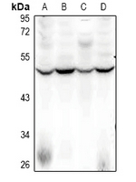 1 - Anti-SFRS11 Antibody AP53720