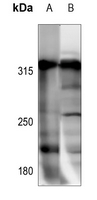1 - Anti-NCOR1 Antibody AP53721