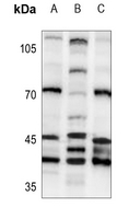 1 - Anti-PSMD6 Antibody AP53722