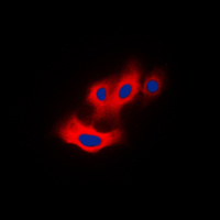 3 - Anti-PAK4 (Phospho-S474) Antibody AP53726