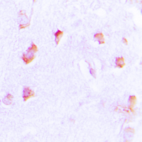 19 - Anti-Collagen 20 alpha 1 Antibody AP53740