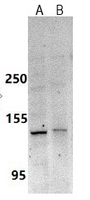 0 - Anti-Collagen 20 alpha 1 Antibody AP53740