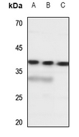 1 - Anti-SLC10A7 Antibody AP53745
